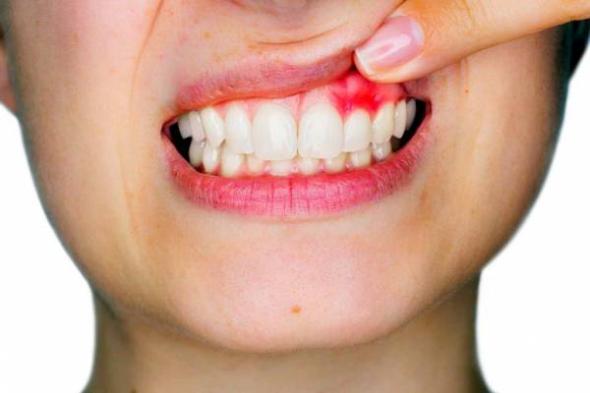 علت دندان درد