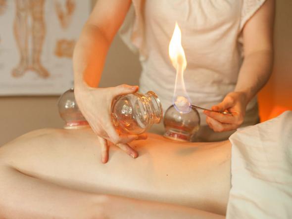 فواید حجامت در درمان بیماری + چه کسانی مجاز به حجامت هستند؟ حجامت چگونه انجام میشود؟