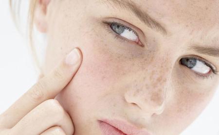 آیا حجامت جوش صورت را درمان میکند؟ فواید حجامت برای پوست فواید حجامت برای پوست