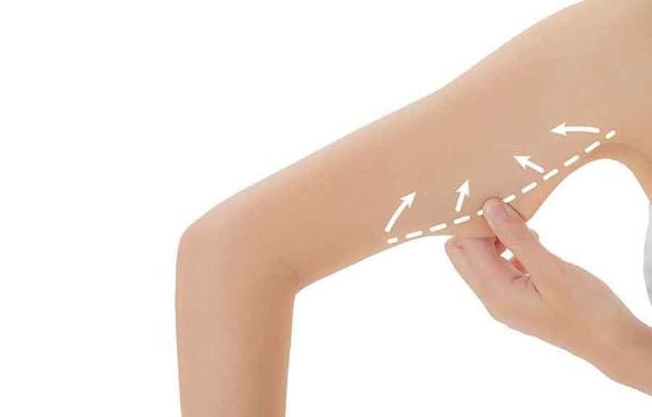 عمل لیپوماتیک یا پیکرتراشی چگونه باعث زیبایی و لاغری میشود؟ لیپوماتیک برای کدام نواحی بدن مناسب است