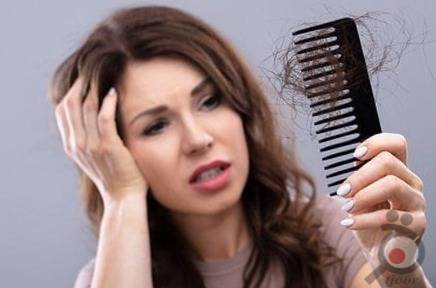 علت ریزش مو در زنان جوان