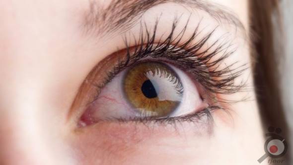 درمان مشکلات چشم