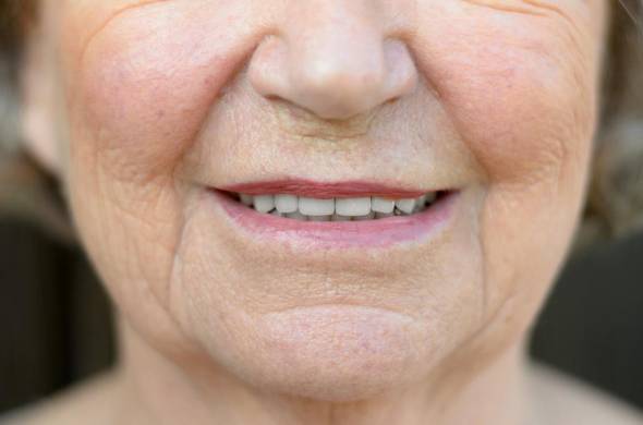 خشکی لب و دهان در افراد مسن