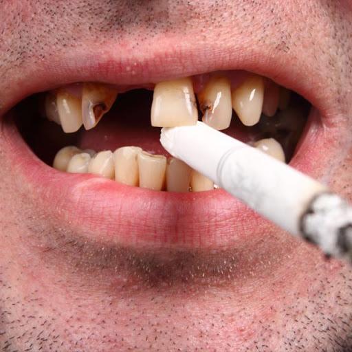 اثر سیگار روی دندان