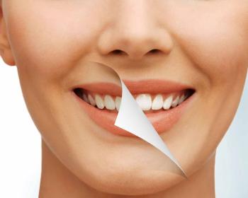 طرح لبخند کامپوزیت