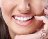 نکات مهم و طلایی در حفظ سلامت دندان