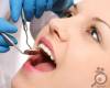 دلایل پوسیدگی دندان عقل