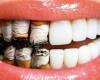 افراد سیگاری چگونه بهداشت دهان و دندان را رعایت کنند؟