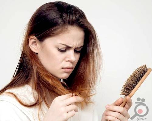 روش های درمان خانگی ریزش موی سر