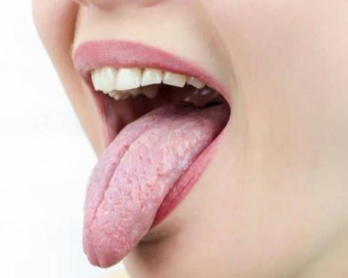 چه عواملی باعث خشکی لب و دهان می شوند؟