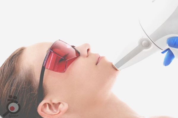 تخفیف ویژه لیزر تخفیف ویژه لیزر