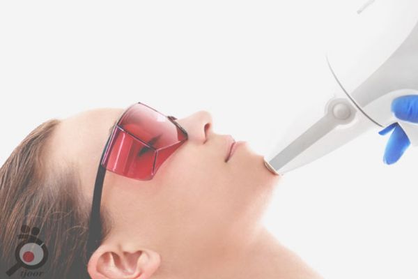 تخفیف ویژه لیزر