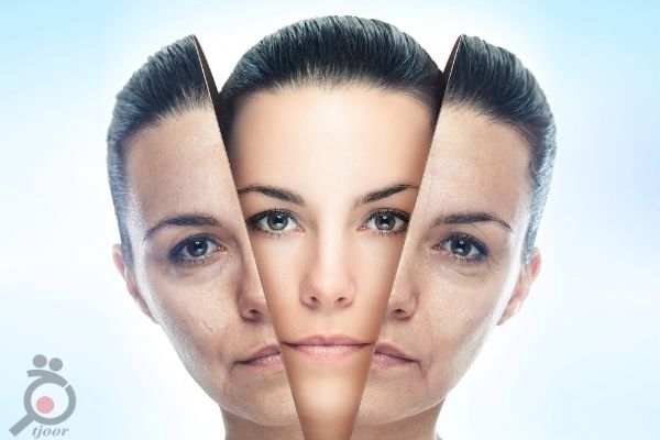 تخفیف ویژه لایه برداری و جوانسازی