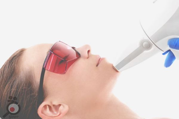 تخفیف ویژه لیزر