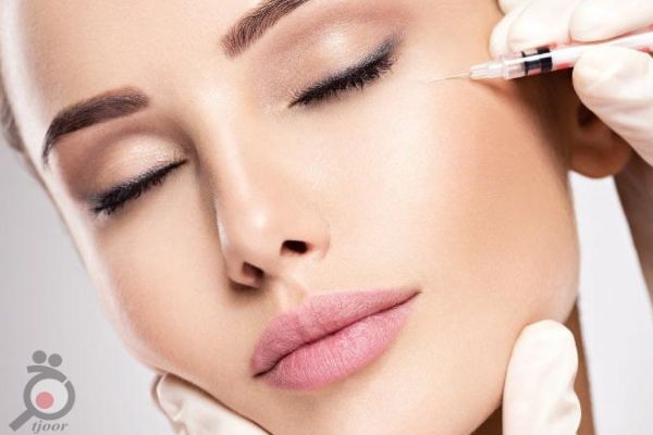 تخفیف ویژه ژل و بوتاکس