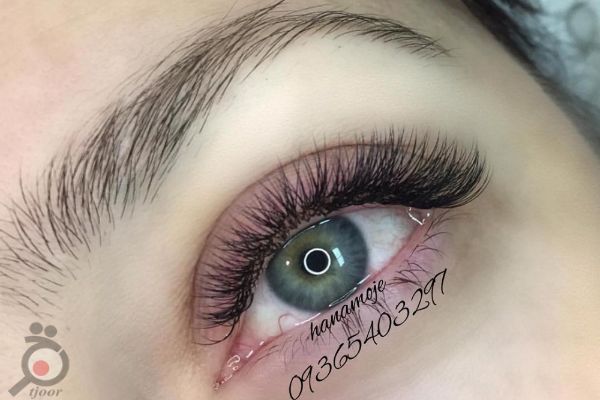 تخفیف ویژه آموزش کاشت