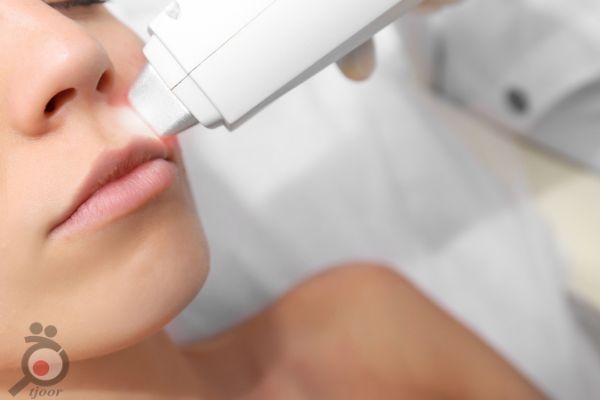 تخفیف ویژه لیزر تخفیف ویژه لیزر