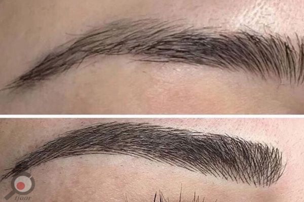 تخفیف ویژه میکروبیلدینگ به سبک فیبروز