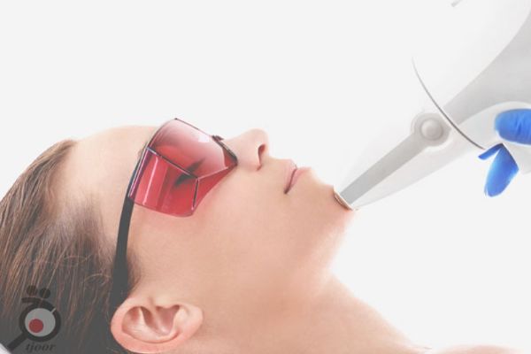 تخفیف ویژه لیزر تخفیف ویژه لیزر