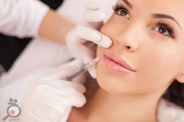تخفیف ویژه ژل تخفیف ویژه ژل