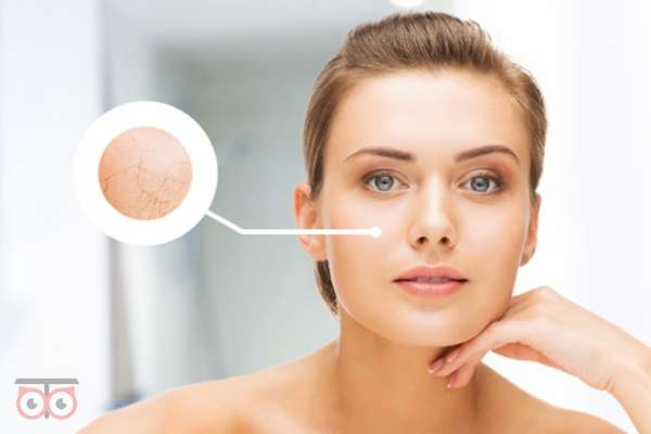 تخفیف ویژه هایفو