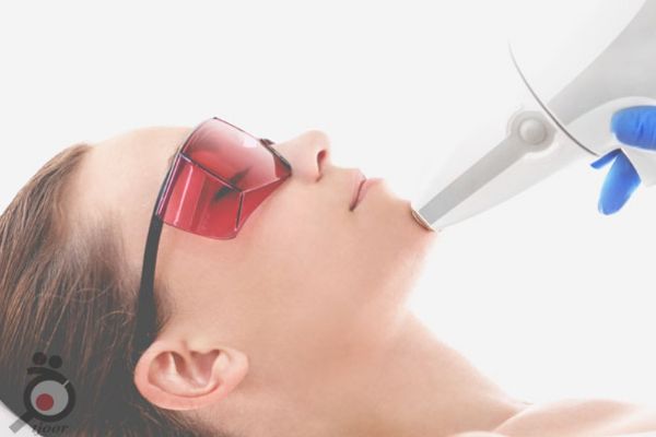 تخفیف ویژه لیزر