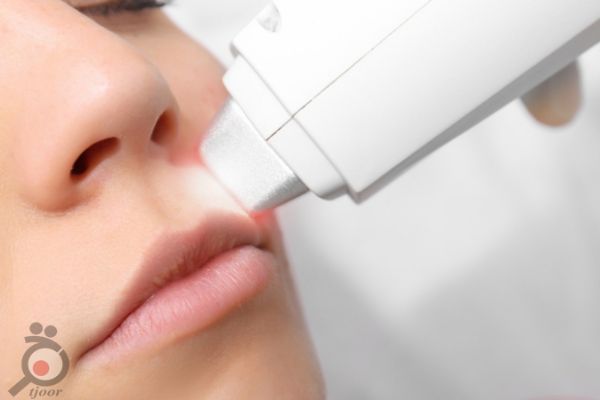 تخفیف ویژه لیزر