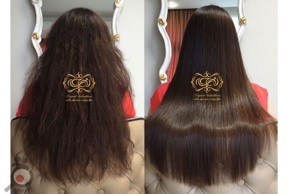 تخفیف ویژه بوتاکس مو