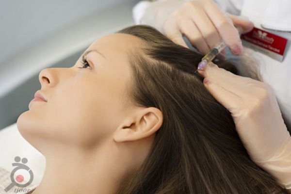 تخفیف ویژه خدمات مو