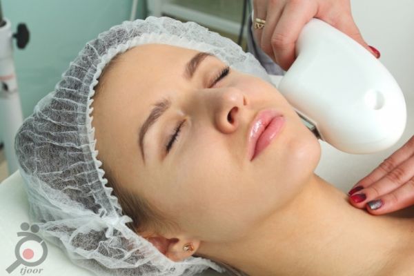 تخفیف ویژه لیزر موهای زائد تخفیف ویژه لیزر موهای زائد