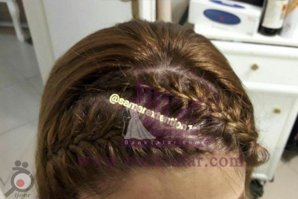 تخفیف ویژه اکستنشن و ترمیم