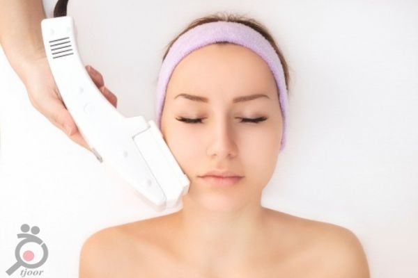 تخفیف ویژه لیزر موهای زائد