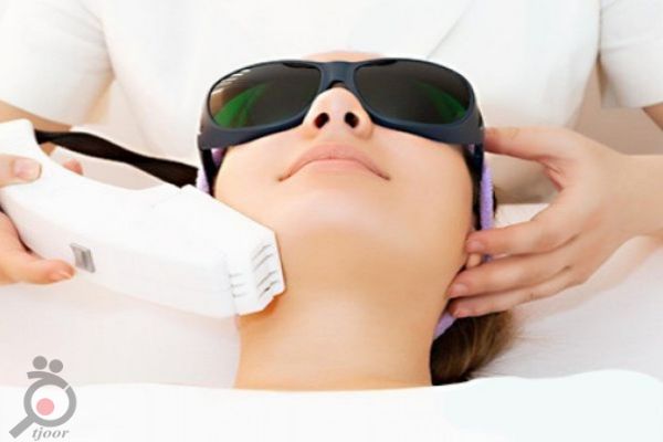 تخفیف پاییزی لیزر موهای زائد