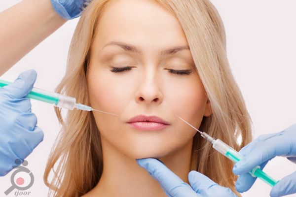 تخفیف تزریق ژل هیالورونیک - زاویه سازی فک