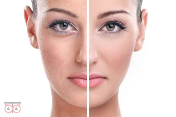 تخفیف ویژه جوانسازی صورت