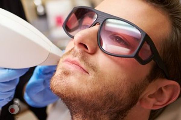 تخفیف ویژه لیزر موهای زائد ویژه آقایان تخفیف ویژه لیزر موهای زائد ویژه آقایان