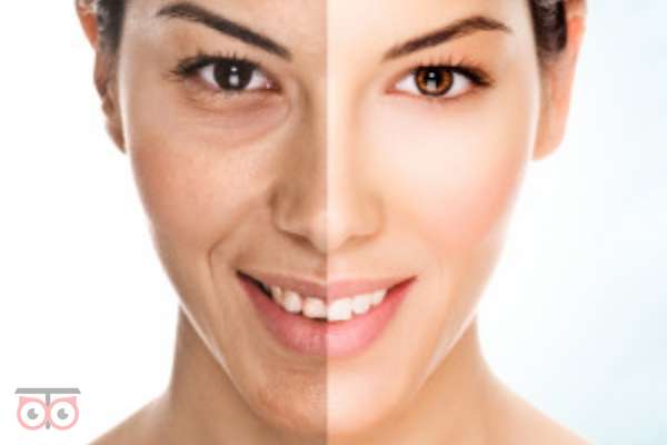 تخفیف ویژه لیزر CO2