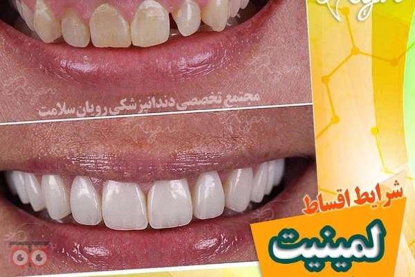 تخفیف ویژه لمینیت تخفیف ویژه لمینیت