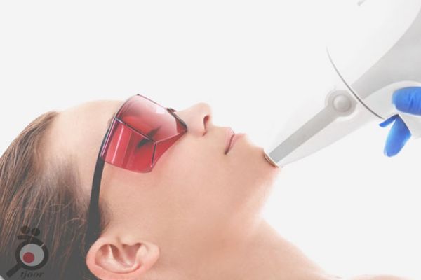 تخفیف ویژه لیزر