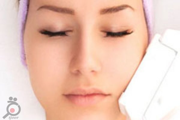 تخفیف ویژه لیزر