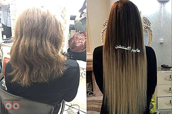 تخفیف ویژه اکستنشن