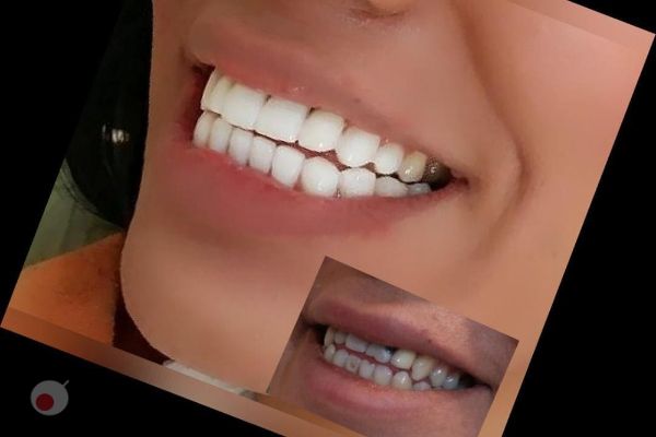 تخفیف ویژه خدمات دندانپزشکی