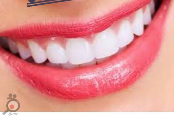 تخفیف ویژه پاییزی