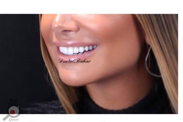 تخفیفات ویژه خدمات آبان ماه