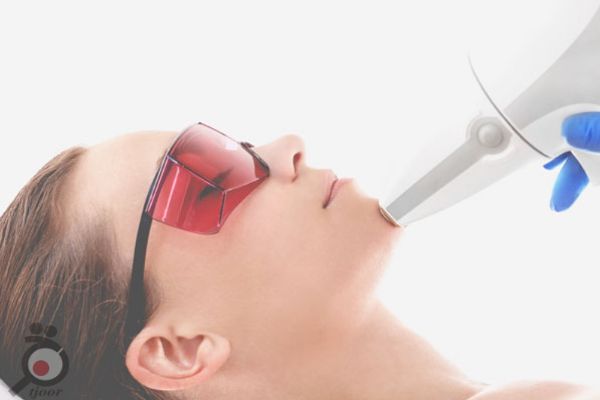 تخفیف ویژه لیزر