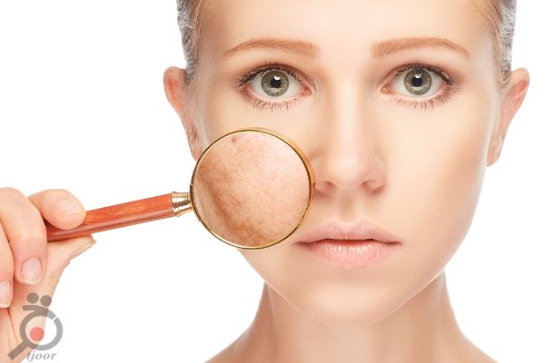 پیشنهاد شگفت انگیز HIFU پیشنهاد شگفت انگیز HIFU