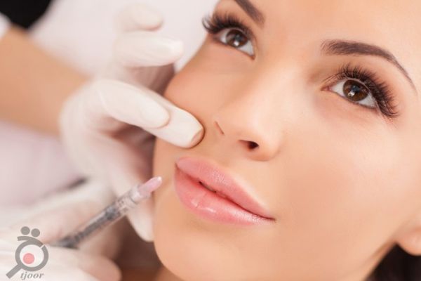 تخفیف ویژه تزریق بوتاکس