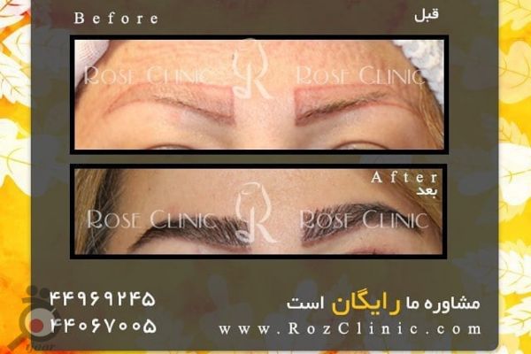 تخفیف ویژه خدمات