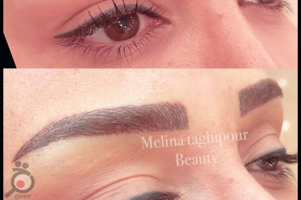 تخفیف ویژه آموزش میگروپیگمنتیشن