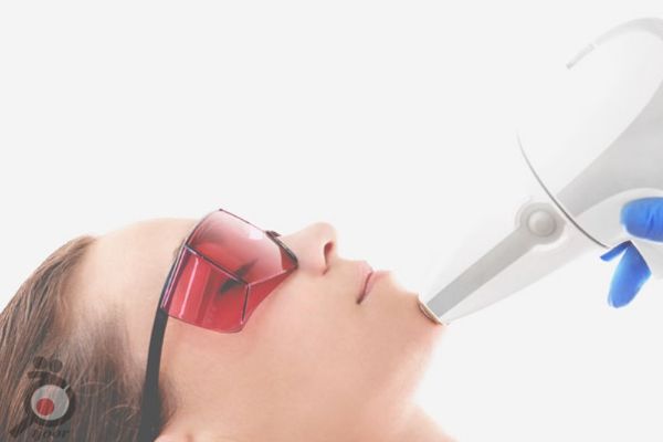 تخفیف ویژه پکیج لیزر